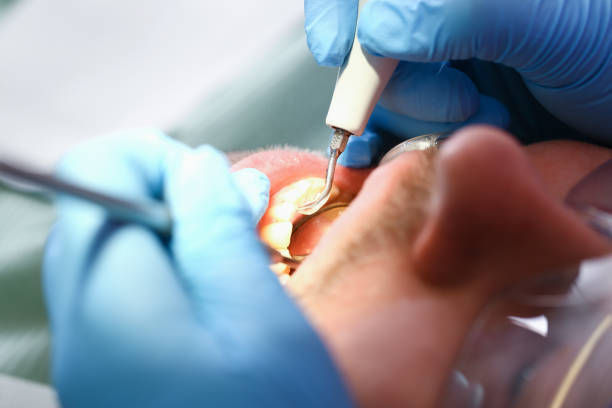 Best Emergency Gum Treatment in Union Springs, AL