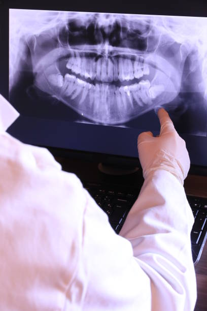 Best Emergency Treatment for Dental Infections or Abscesses in Union Springs, AL